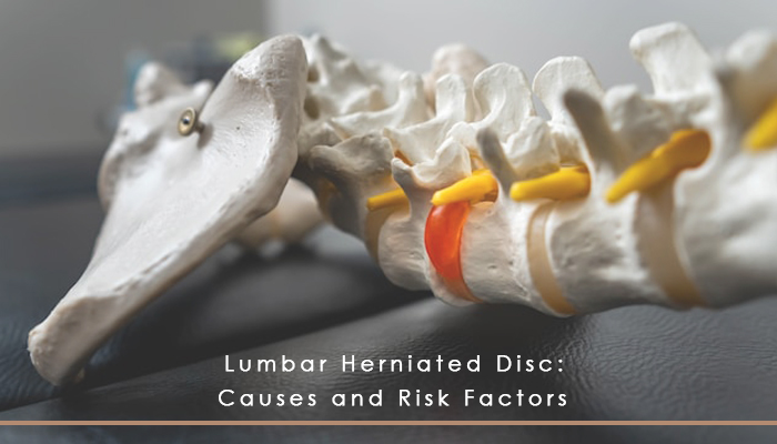 Read more about the article 腰椎间盘突出的原因和诱因
